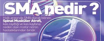 Haberler sağlık haberleri sma( spinal müsküler atrofi) nedir? Sma Nedir