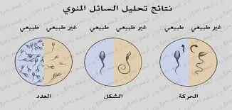 Maybe you would like to learn more about one of these? Ø´Ø±ÙˆØ· ØªØ­Ù„ÙŠÙ„ Ø§Ù„Ø³Ø§Ø¦Ù„ Ø§Ù„Ù…Ù†ÙˆÙŠ Ø§Ù„Ø·Ø¨ÙŠØ¹Ù‰ Ù…Ù‚Ø§Ù„