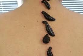 Suluk Ve Tedavisi Sakarya Suluk Uretimi Ve Sakarya Suluk Satisi 0542 230 53 98
