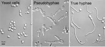 Yeast Hyphae Under Microscope Medical Laboratory Medical Laboratory Scientist Medical Laboratory Science
