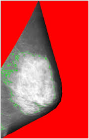 We did not find results for: Determinants Of Breast Size In Asian Women Scientific Reports