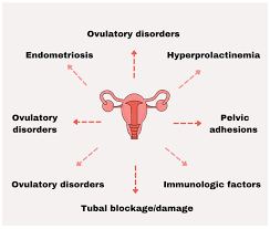 Image result for Female Infertility