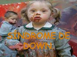 Limitación Auditiva