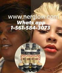 🌸🌺KÈLKESWA LWIL OU ACHTE WAP JWEN YON LÒT LWIL GRATIS.🌺🌸 Spesyal sa ap  fini dimanch swa a Minuit. KÈLKESWA PWOBLÈM CHEVEW GENYEN NAP BAW SOLISYON.  Si chevew ak cheve pitit ou ap