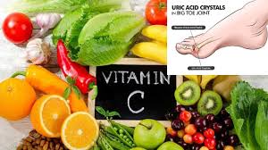 Artriticilor ca si celor cu oxalemie, li se vor interzice si alimentele bogate in acid oxalic; Totul Despre Acidul Uric Cauze Simptome Tratament Youtube