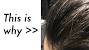 Waxy Buildup On Hair