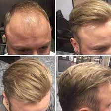 Get a quality haircut and color at a salon near you. Mens Hair Pieces Non Surgical Hair Replacement System For Men