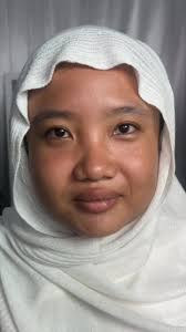 Herceg Erika Before and After