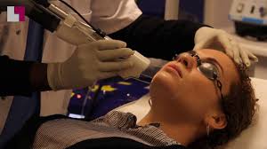 La sensación de estar en las nubes. Epilation Laser Definitive Rouen Visage Et Corps Eliminer Vos Poils Indesirables