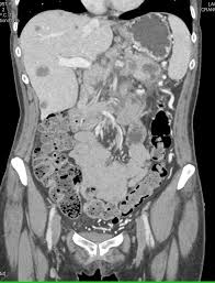 Pin On Radiology