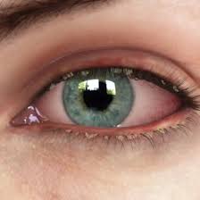 Image result for Blepharis bainesii