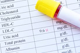 Both High And Low Uric Acid Levels Tied To Higher Mortality