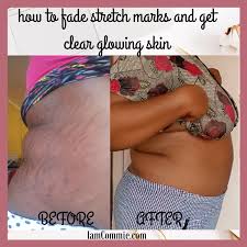 Pin On Skincare