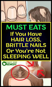 These Foods Will Stop Your Hair Loss Brittle Nails And Will Make You Sleep Like A Baby Healthy Home Remedy Hair Loss Brittle Nails Shimmer Eye Makeup