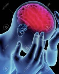 Quand ils vont au cerveau, c'est l'accident vasculaire cérébral. Maux De Tete Cerveau Migraine Maladie D Alzheimer Ou La Demence Notion Banque D Images Et Photos Libres De Droits Image 10750135