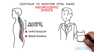 Image result for Spinal Shock