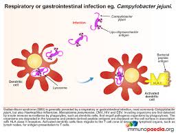 This leads to weakness, numbness, and tingling, and can eventually cause paralysis. Guillain Barre Syndrome Gbs Immunopaedia