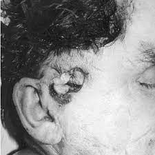 There's a huge debate about whether to use buckshot or slugs for your home defense shotgun. Pdf Multiple Suicidal Injuries With Shotgun Slugs
