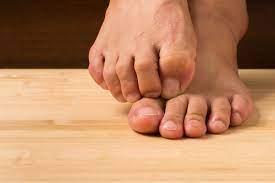 How To Remove Athlete S Foot From Carpet Updated Singapore Carpet Cleaning Pte Ltd