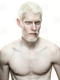 Albino nipples