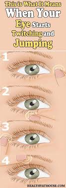 Eye Twitching Is Usually Caused By Fatigue Stress Excessive Amounts Of Tobacco Alcohol Caffeine And Few Other Factors Eye Health Eye Twitching Health Tips