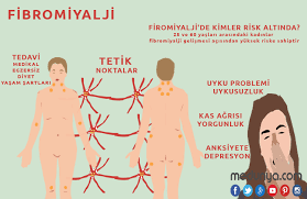 Bu noktalar daha çok kaslar, tendonlar ve kemikler olmaktadır. Fibromiyalji Hipokratin Yeri