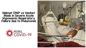 Orders over $99 ships for free with. Helmet Cpap Vs Venturi Mask In Severe Acute Hypoxemic Respiratory Failure Due To Pneumonia Rebel Em Emergency Medicine Blog