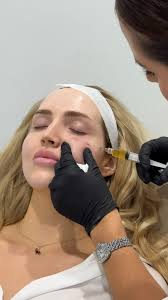 INTRODUCING: REJURAN REJURAN is a New Concept Bio-Regenerator (you know we  love all things regenerative medicine) made of polynucleotides, which are  DNA fragments of a specific size derived from wild salmon. These