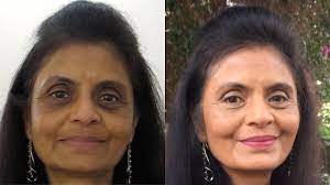 How To Cover Dark Circles Hyperpigmentation Indian Tan Skin Covering Dark Circles Lipstick For Dark Skin Light Pink Lip Gloss