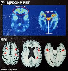 Below are relevant articles that may interest you. Concussion Symptoms Treatment Definition Britannica