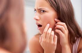 Centre dermo peeling sertifié pour la peau des hommes. Traiter Et Supprimer Les Cicatrices D Acnes Avec Un Peeling Du Visage
