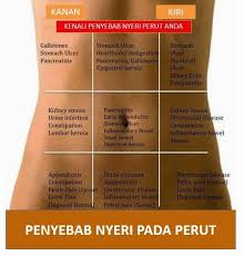 Mirantha Menentukan Penyebab Nyeri Perut Berdasakan Lokasi Dan Sifat Nyeri