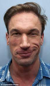 (2008), mongrels (2010) and dr christian: Embarrassing Bodies Dr Christian Jessen Has Wayne Rooney Hair Implants After Twitter Mocks Bald Patch Daily Mail Online