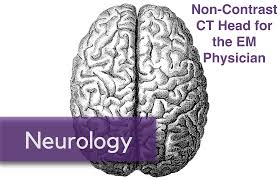 Image result for CT Head