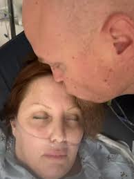 Gastric sleeve surgery complications in Mexico