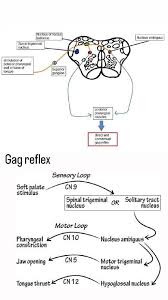 Image result for Gag Reflex