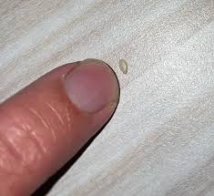 Image result for bed bugs eggs