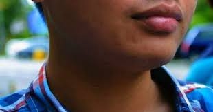 Asthma asthma is a disease that has spread widely throughout the world in the last 20 years. Tehtarik Biodata Nur Fitri Azmeer Nordin Pelajar Malaysia Dipenjara