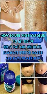 Pin On Vicks Vaporub Cold Remedy