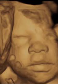 Don't be a Richard Cranium! It's not hard to be human! #dontbeaRichard