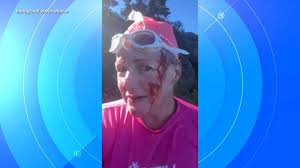 Woman attacked by otter while swimming says 'it felt like a human'