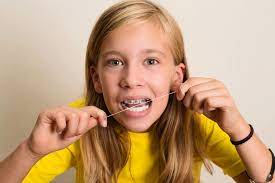 Lastly, interdental brushes are very effective for those with existing periodontal problems, wide tooth spacing or with braces, bridgework or implants.2. How To Floss With Braces A Guide For Kids Weiss Tor Orthodontics