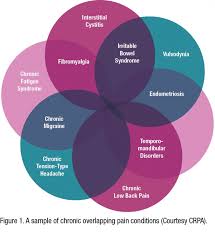 Complex Management Of Chronic Overlapping Pain Conditions