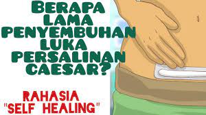 Di video berikut ini membahas bagaimna tahapan penyembuhan luka. Tempoh Pemulihan Luka Jahitan Selepas Bersalin