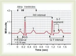 How To Read A Normal Ecg Electrocardiogram Normal Ecg