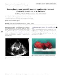 Upgrade your toilets fill performance with this proven toilet tank fill valve. Pdf Double Giant Thrombi In The Left Atrium In A Patient With Rheumatic Mitral Valve Stenosis And Atrial Fibrillation