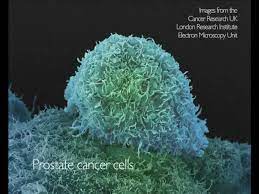 On the face, the appearance of this skin cancer can be quite varied. What Does Cancer Look Like Cancer Research Uk Youtube