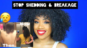 12 best products to stop hair breakage in 2021. How To Stop Hair Breakage And Shedding Black Natural Tips