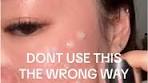 Effective Korean Skincare for Acne Scarring