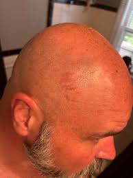 Bluegill fish have sharp teeth